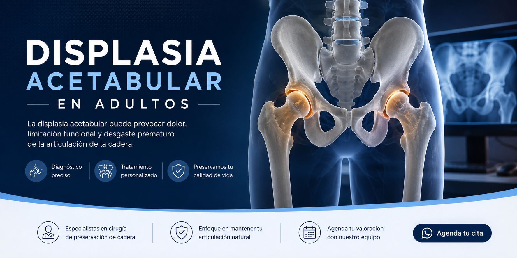 Displasia Acetabular en Adultos
